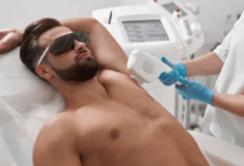 What Makes Laser Hair Removal Better Than Shaving?