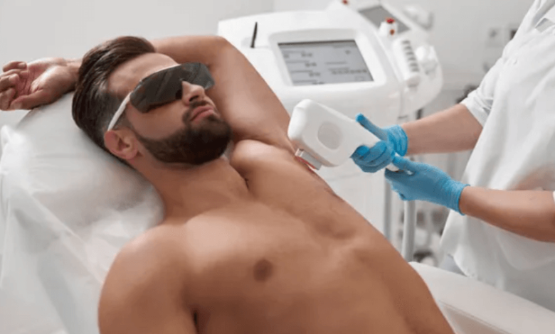 What Makes Laser Hair Removal Better Than Shaving?